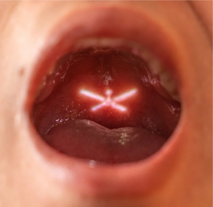 A small fan-shaped projection appears in the back of an open mouth.