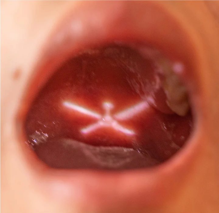 An illuminated ceiling fan is projected inside an open mouth.