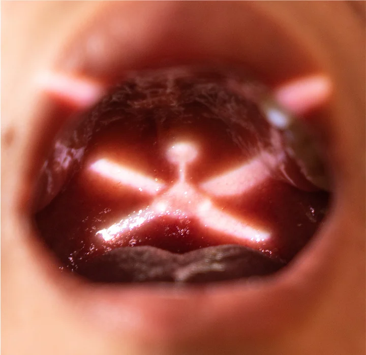 Another view of a projected ceiling fan within the mouth.